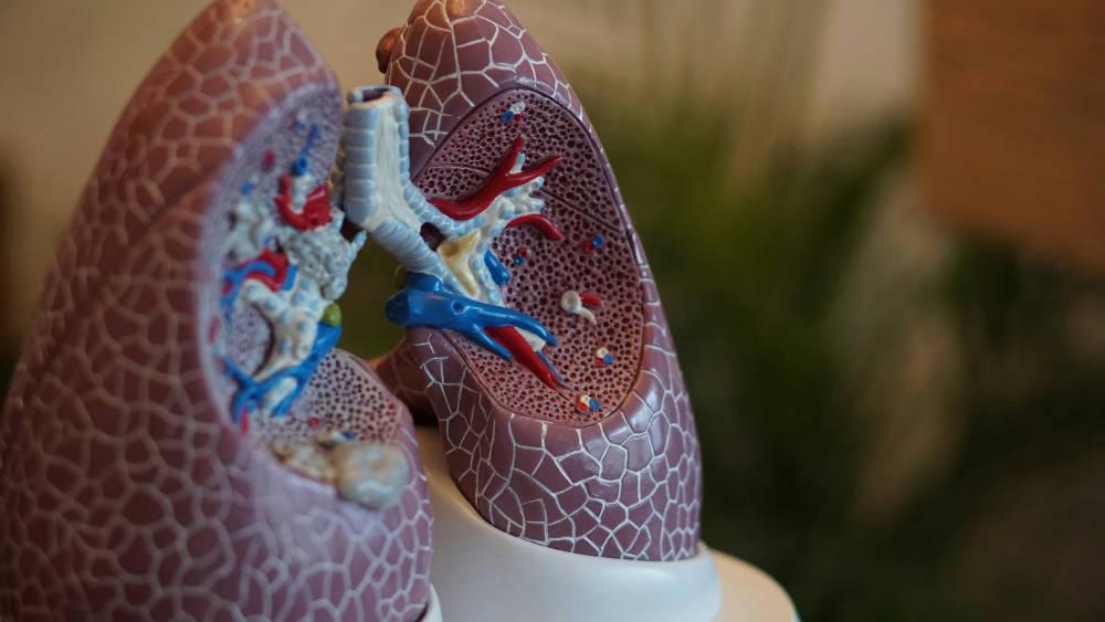 24 de marzo – Día Mundial de la Tuberculosis